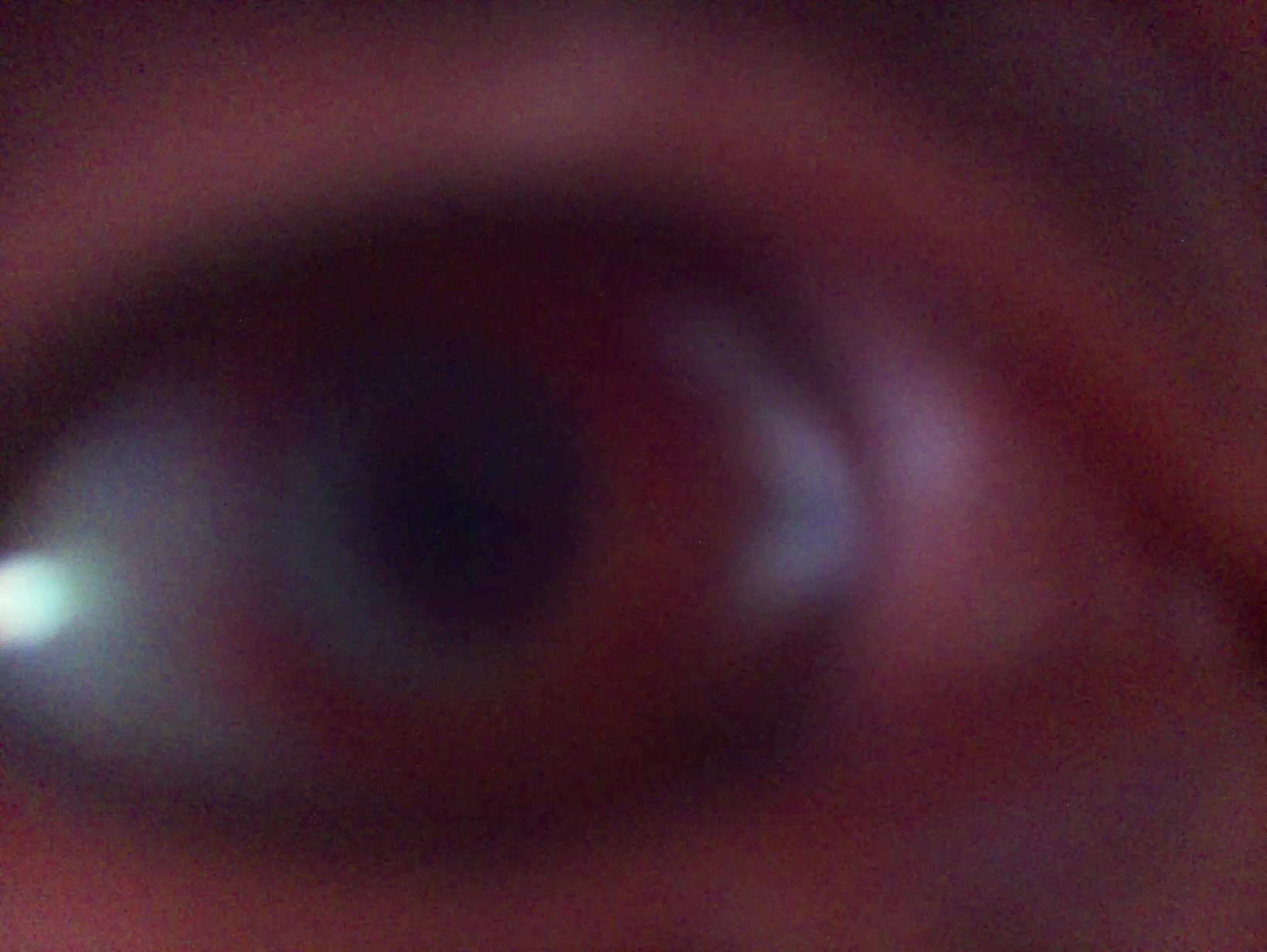 APB! Crime Reference: 68AB0600299CD. A Metha addict is wanted for lurking