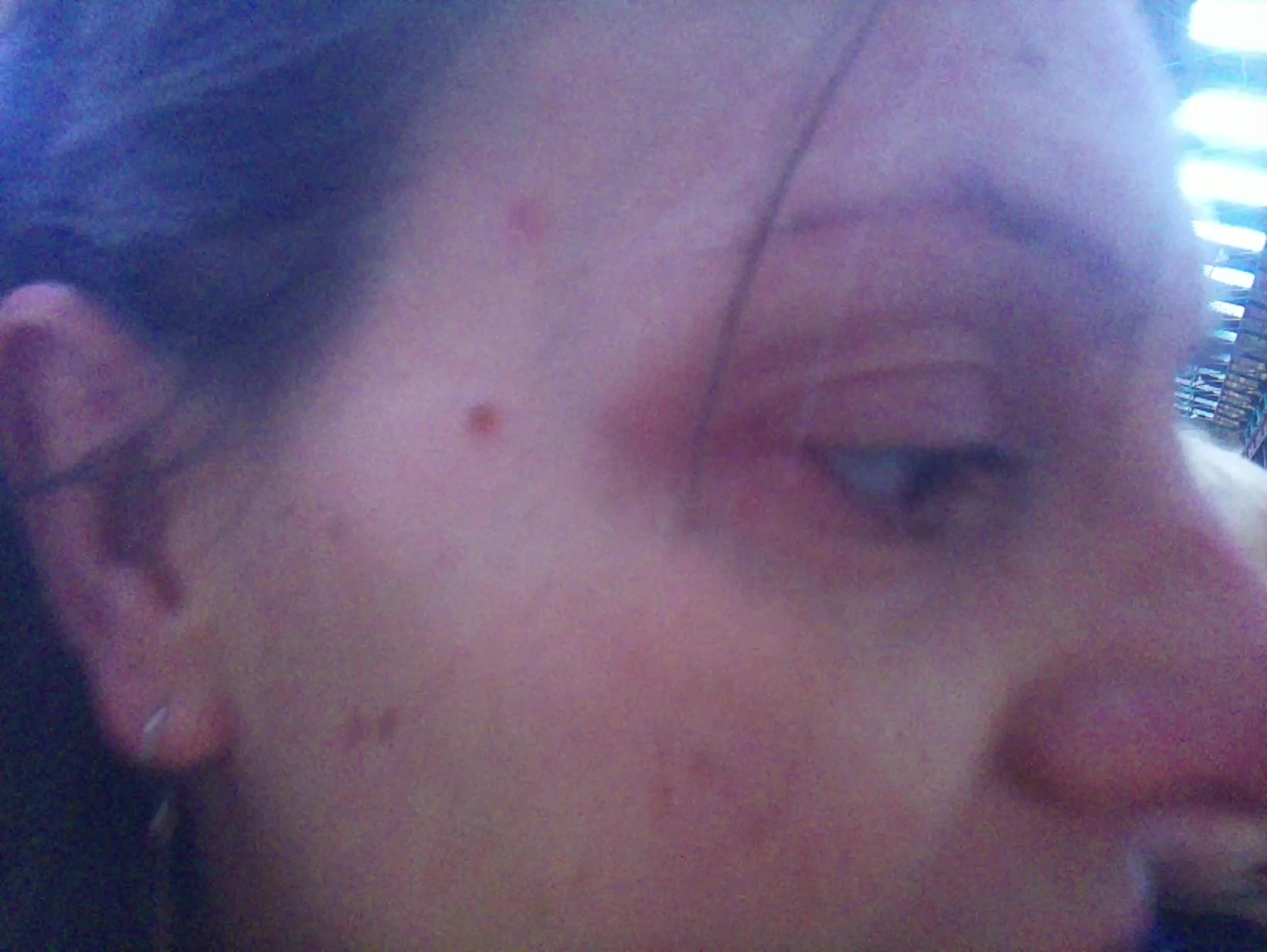 APB! Crime Reference: 68FCCDFDCBCE2. A Metha addict is wanted for lurking