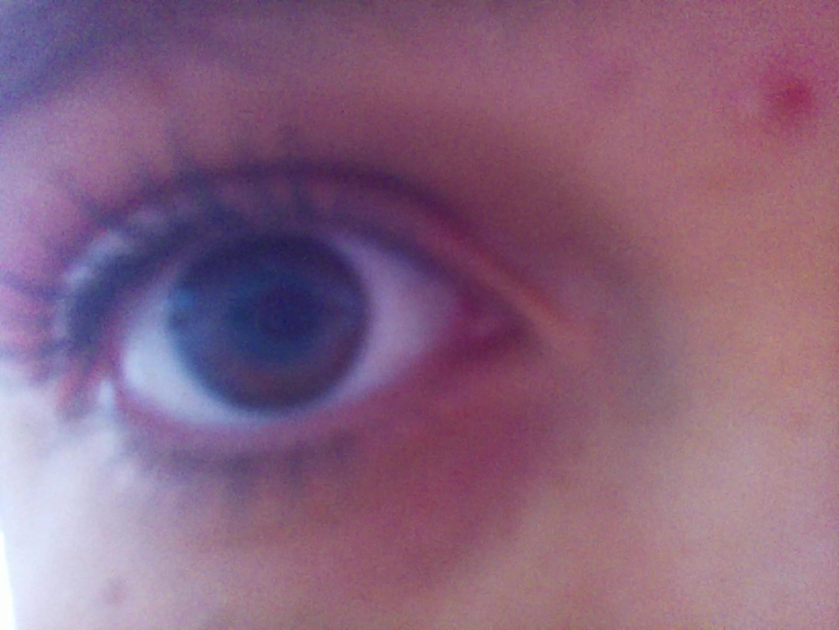 APB! Crime Reference: 68F4F35224251. A Metha addict is wanted for lurking