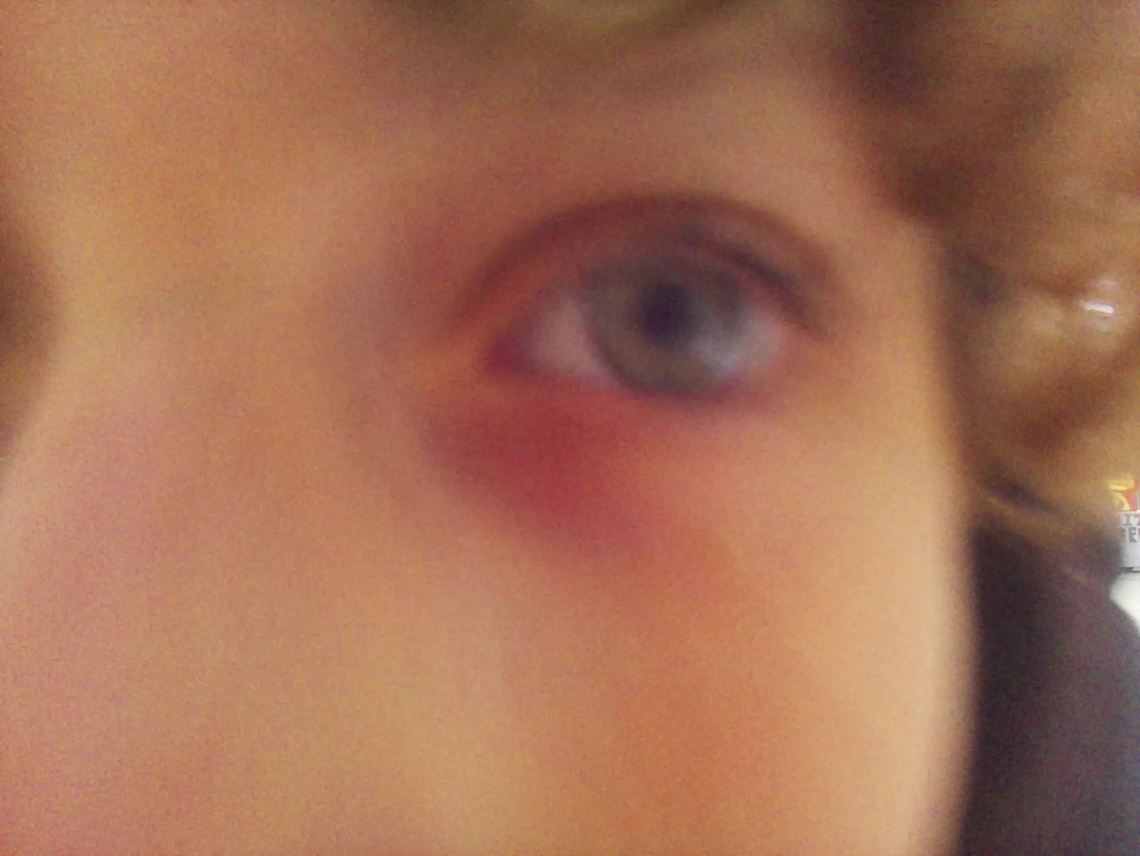 APB! Crime Reference: 6922F5AC89C15. A Metha addict is wanted for lurking